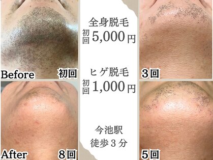 エクレ 今池店(EKURE)の写真
