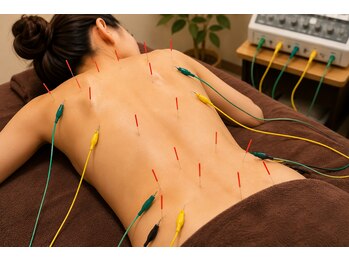 なかむら鍼灸整骨院の写真/首・肩コリ・腰痛・全身の疲れなどお客様一人一人のお悩みに合わせたオーダーメイド施術をご提供します◎