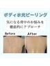 【背中ニキビでお悩みの方へ】水光ピーリング/背中 ★スタッフ施術