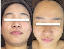 アネル 浦添店(anel)/