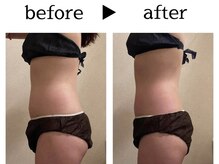 サロン ド ユキフラン(Salon de Yukifranc)/施術部位→お腹・ウエスト