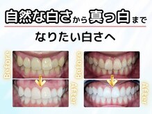 プラチナムビューティ 福山駅前店