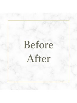 ルーツ 武蔵小杉(R∞ts)/お客様ビフォーアフター