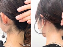 ミース 熊本店の雰囲気(【うなじビフォーアフター】ブライダルにもお勧めなうなじ脱毛☆)