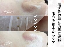 セリジェ 青山(Cerisier)の雰囲気（【黒ずみに】パッと見キレイなお鼻も徹底ケア☆ツルツルな印象へ）