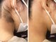 エピファニー(Epi phany Total Beauty Salon)の写真
