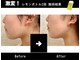 アテ 国分寺店(Ate)の写真/韓国で話題の脂肪分解×最新痩身機器の最強タッグで脂肪、浮腫スッキリ★