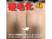 カナウ(KANAU)の雰囲気（男性の3人に1人が【硬毛化】/背中を省いたメニューも作れます◎）