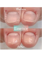 エッセンス (Essence)/ディープケア＋補強コーティング