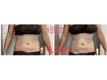 リリィ(LILIY)/お腹サイズダウン