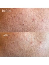 ブリリアントライフ(Blilyant life)/YouTuberにも人気！