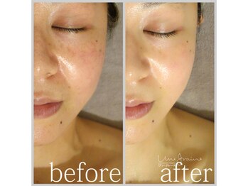 アン グレーヌ 自由が丘(unegraine)/輪郭スッキリ、頬はふっくら♪