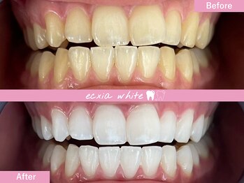 エクシアホワイトニング 札幌中島公園店