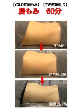 リア(Lia)/腸もみ 60分