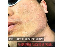 ラフ(LaFF)の雰囲気（毛質・肌質に合わせた効果重視の施術で圧倒的な抜けをご実感。）