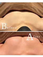 ロココ 水戸店(Rococo)/バストアップBefore &nbsp;After