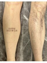 サロン エム(saron M)/お客様ビフォーアフター