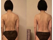 あてやか