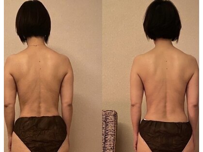 あてやかの写真