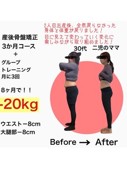 リノア(Linoa)/産後ママさんのビフォーアフター