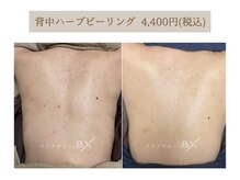 ビーエックス(.BX)