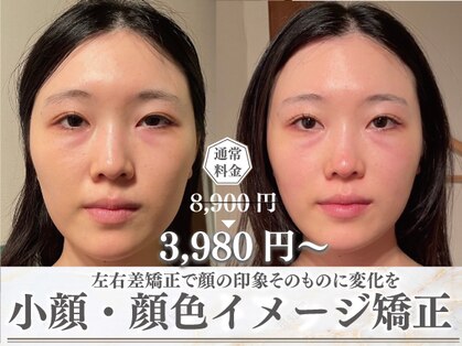 モアフェイス 池袋店(More Face)の写真