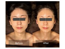 レーヴリゼ(Revelise)/頭蓋骨小顔矯正＋整顔マッサージ