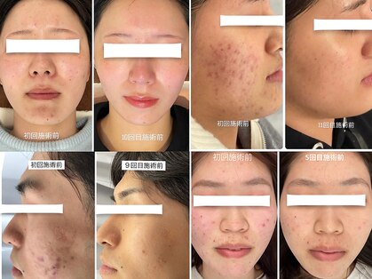 スマイルビューティラボ(Smile Beauty lab.)の写真