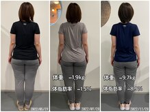 ナナ 大塚店(NANA)/BeforeAfter