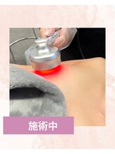 リリースキンケア(Lily skincare)/ローマピンク40%オフモニター