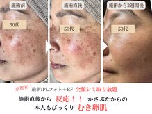 エソア(esoa)の雰囲気（シミケアしながら同時に肌質改善♪施術直後から驚きの反応が！！）