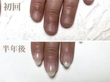 深爪のお悩みの方へのメニューございます！フォトギャラ多数掲載