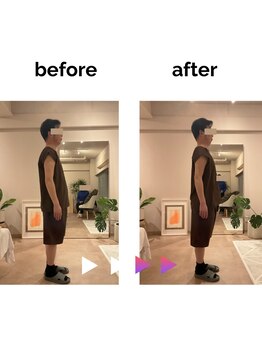 フィデル(fidele)/肩の位置改善【神宮前/表参道】