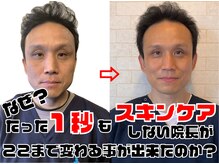 ４７歳でもここまで変われる！独自のフェイシャルケア！！