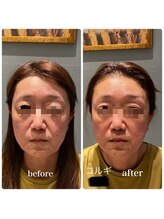 ベルフルール 西18丁目店/韓国コルギ