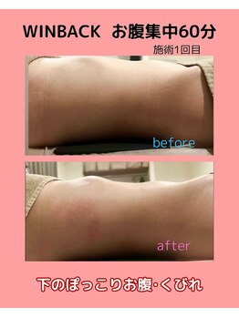 クレビア(CRE'BIA)/便秘、ぽっこりお腹、腸活