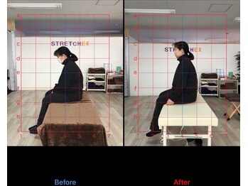 ストレチックス 近江八幡店/BeforeAfter