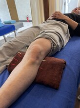 ハヤ治療院(HAYA治療院)/色々な箇所への鍼灸施術