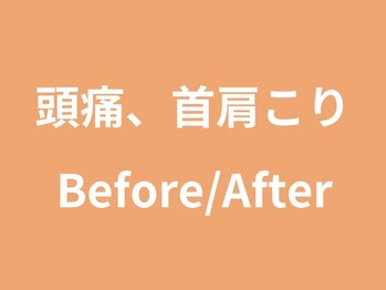サンシー整体(SunCY整体)/頭痛整体Before/After