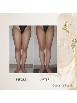 クーラ テュセ(Coeur la Tusais)/下半身集中痩身