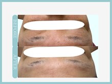 アコガレコガオ 山形店/