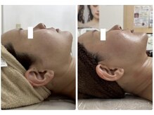 カレン(KAREN)/頬肉アゴ下二重あご最強脂肪燃焼