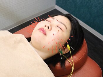 もりわき骨盤鍼灸整骨院 梅田院の写真/結婚式に向けて最高のコンディションへ導く【ブライダル美容鍼】写真映えするスッキリ小顔へ♪