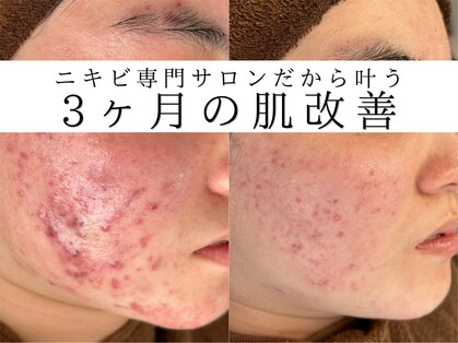 アエオボンヌール(A.E.O BONHEUR)の写真