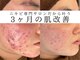 アエオボンヌール(A.E.O BONHEUR)の写真