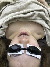 ナノハナ/鹿沼市の全身脱毛のナノハナ