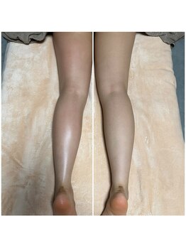 ヌー(gnu)/カッピング