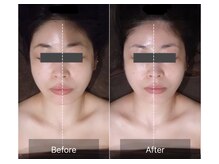 レーヴリゼ(Revelise)/頭蓋骨小顔矯正＋整顔マッサージ