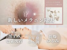 エトス(ETHOS)