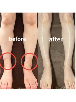 ジョイ 茅ヶ崎北口店(JOY)/before　after